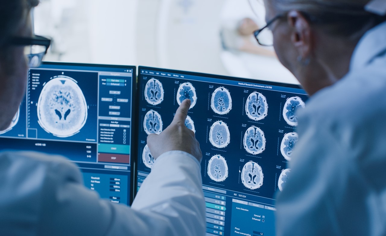 Healthcare professional reviewing brain imaging data on a screen Healthcare professional reviewing brain imaging data on a screen