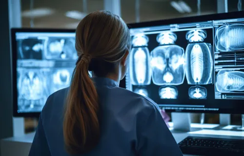 Consultant looks at brain scan